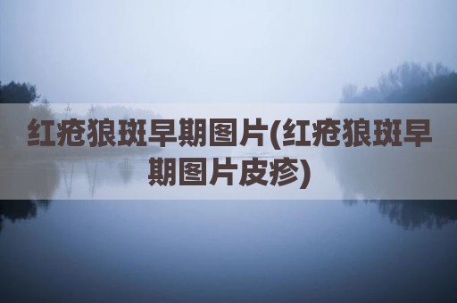 红疮狼斑早期图片(红疮狼斑早期图片皮疹)
