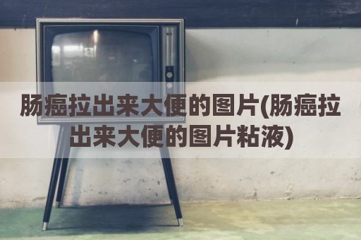 肠癌拉出来大便的图片(肠癌拉出来大便的图片粘液)