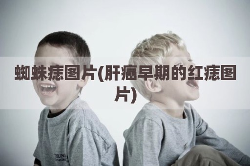 蜘蛛痣图片(肝癌早期的红痣图片)