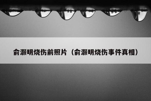 俞灏明烧伤前照片（俞灏明烧伤事件真相） 第1张
