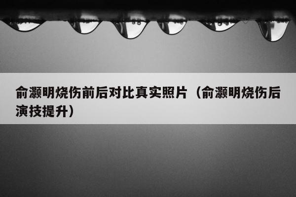 俞灏明烧伤前后对比真实照片（俞灏明烧伤后演技提升） 第1张